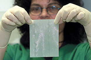 人造皮肤烧伤新曙光